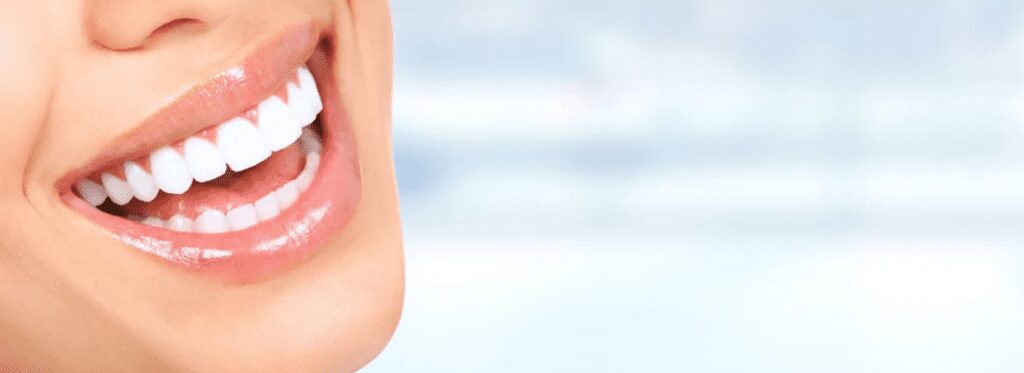 zoomed and cropped image of a beautiful white smile teeth whitening cosmetic dentistry dentist in Alpharetta Georgia