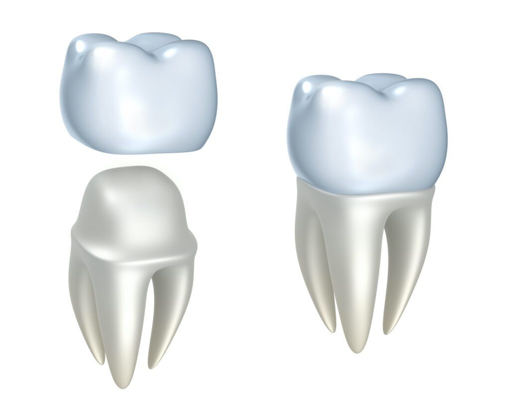 Dental crowns offer multiple benefits. They could restore the tooth's function, allowing patients to chew and speak normally.
